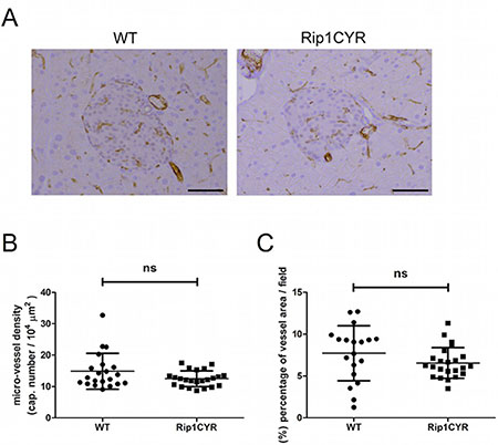 CYR61 does not affect the vasculature in the islets of Langerhans.