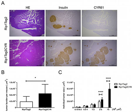 CYR61 promotes growth of &#x03B2; cell-derived tumors.