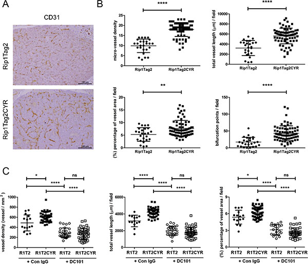 CYR61 enhances VEGF-dependent tumor angiogenesis in &#x03B2; cell-derived tumors.
