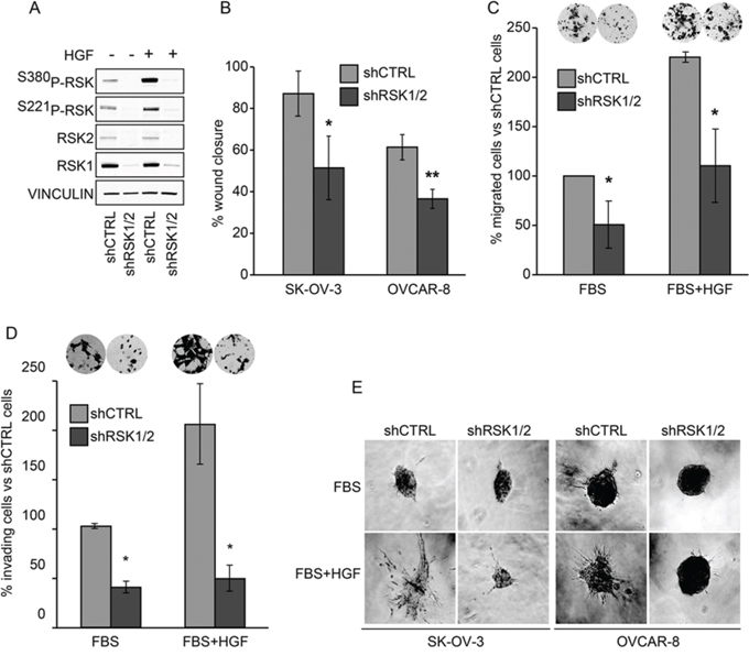 RSK1 and RSK2 double knockdown impairs motility and invasiveness of ovarian cancer cells in vitro.