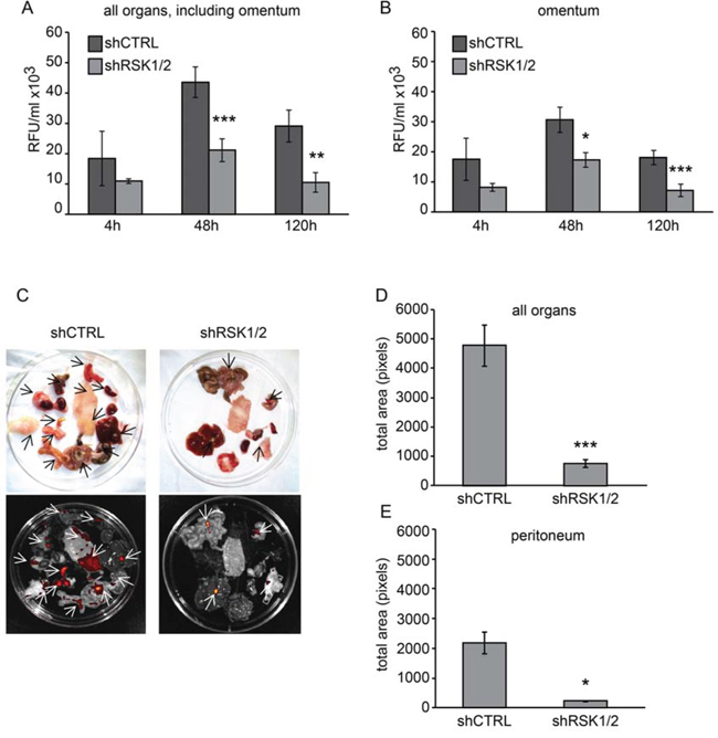 RSK1 and RSK2 silencing impairs the ability of ovarian cancer cells to form peritoneal metastases in vivo.