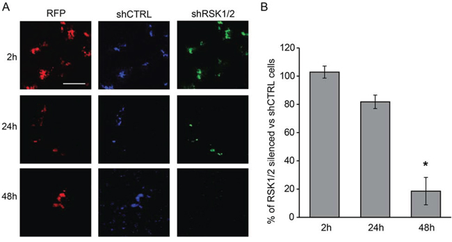 RSK1 and RSK2 silencing impairs the ability of ovarian cancer cells to form haematogenous metastases in vivo.