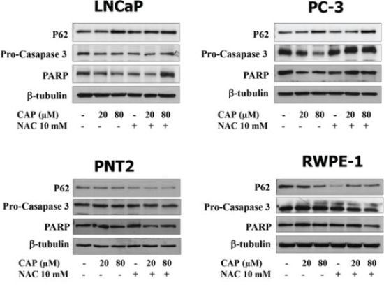 Apoptosis induction by capsaicin in prostate cancer cells but not in normal prostate cells.