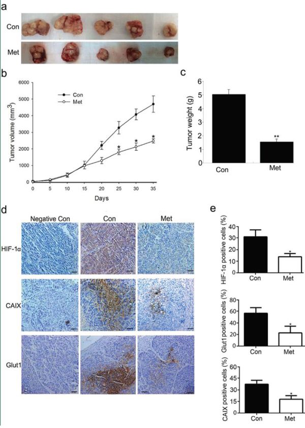 Metformin administration inhibits HCC xenograft tumor growth.