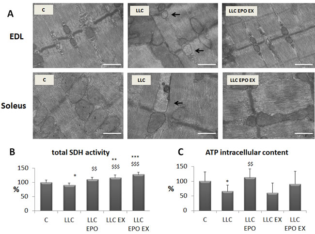 Exercise training and EPO restore mitochondrial morphology in LLC-bearing mice.