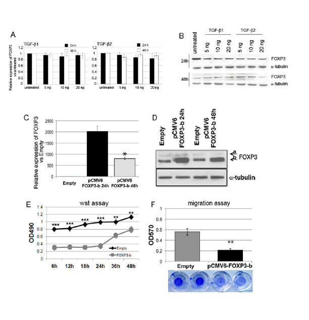 Modulation of FOXP3 expression affects the proliferation and migration of GB-NS.