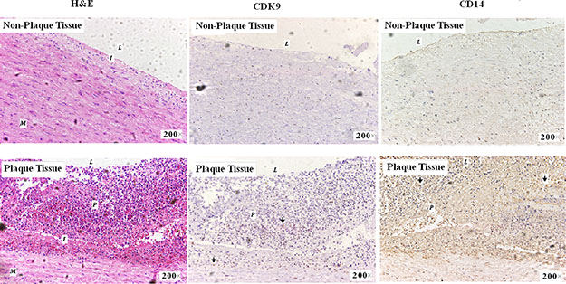 Immunohistochemistry staining of CDK9 and CD14 in artery wall sections (magnification 200&#x00D7;).