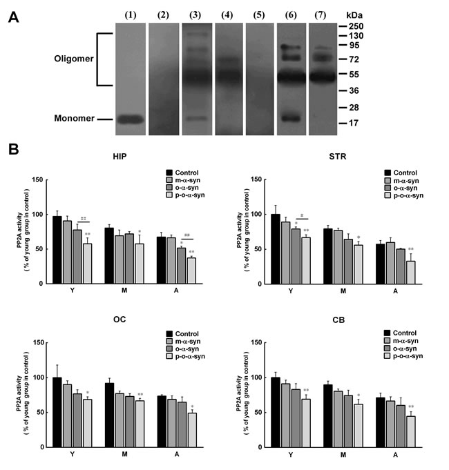Effect of phosphorylated and non-phosphorylated oligomeric &#x3b1;-syn on PP2A activity.