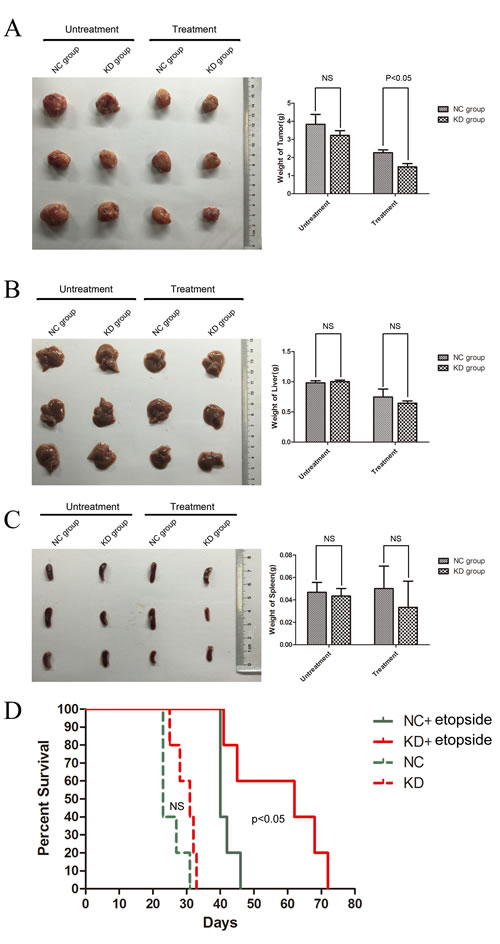 Downregulation of SIRT1 decreased the tumorigenesis of K562 cells