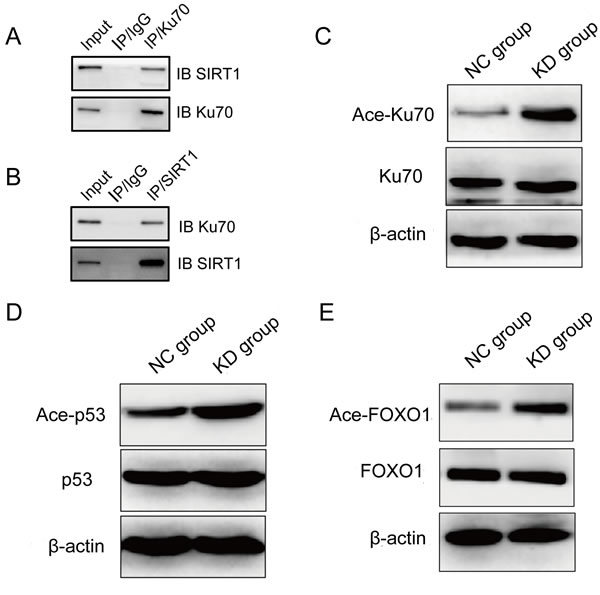 SIRT1 physically interacted with Ku70 and deacetylated Ku70, p53 and FOXO1 in leukemia cells after etoposide treatment.