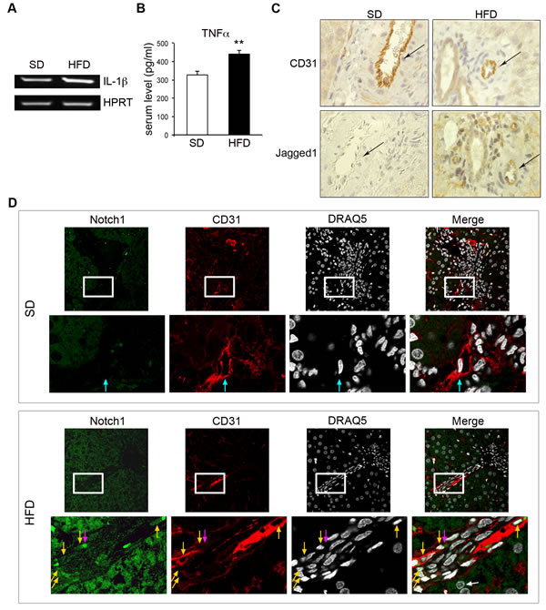 Jagged1 and Notch1 are upregulated in the liver vessels of rats with low-grade chronic inflammation.