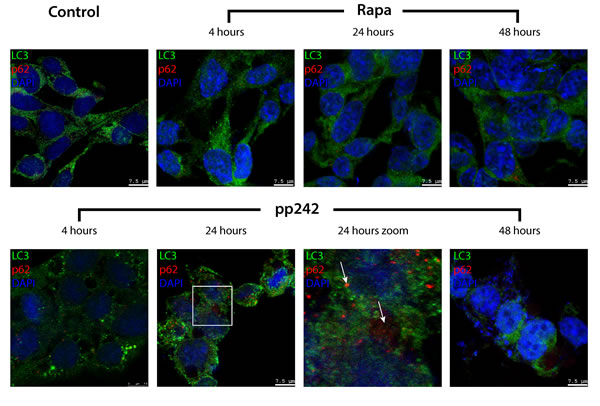 Degradation of autophagy-specific substrate p62/SQSTM and autophagy marker LC3 is disturbed in pp242-treated ERas cells.