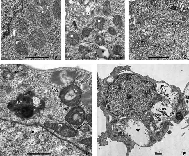 Transmission electron microscopy (TEM) images showing the ultrastructure of control or treated with rapamycin and pp242 ERas cells.