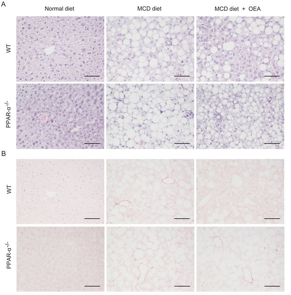 OEA improved liver histology in MCD diet-induced fibrosis mice via PPAR-