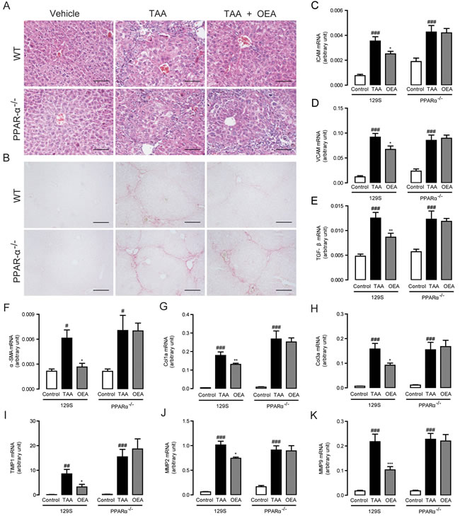Anti-fibrotic effects of OEA in TAA-induced fibrosis mice were mediated by PPAR-