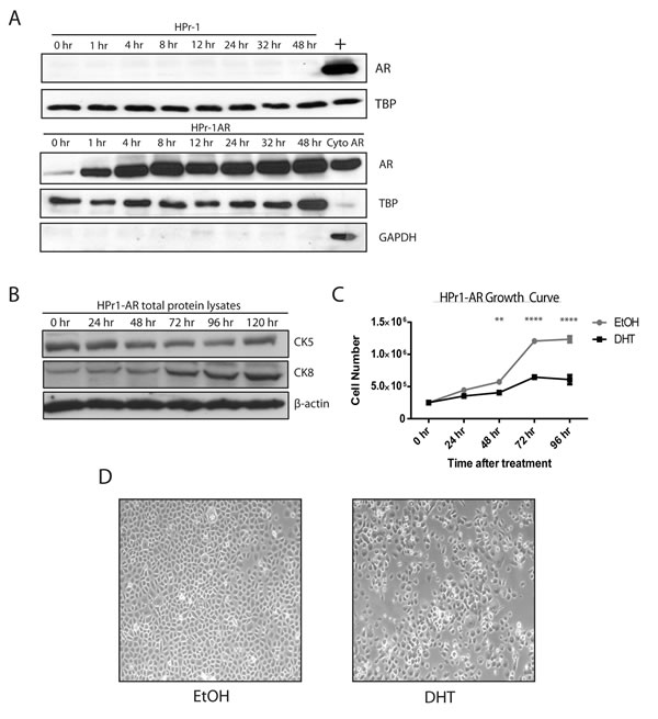Characterization of short-term androgen treatment of HPr1-AR cell lines.