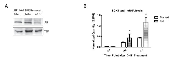 Bovine pituitary extract removal reduces nuclear AR levels and results in more reproducible transcript levels.