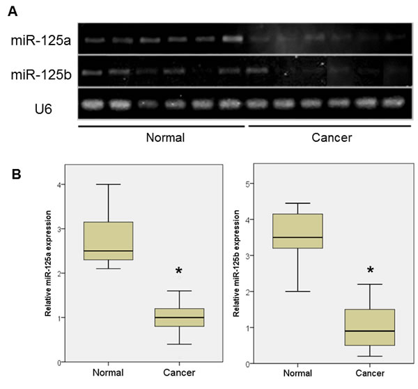 miRNA expression in ovarian cancer tissue and normal ovarian epithelial tissue.