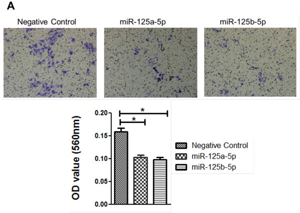 Invasion and wound healing assays in miR-125a, miR-125b-treated, and knockdown of EIF4EBP1 in SKOV3 and OVCAR-429 ovarian cancer cells.