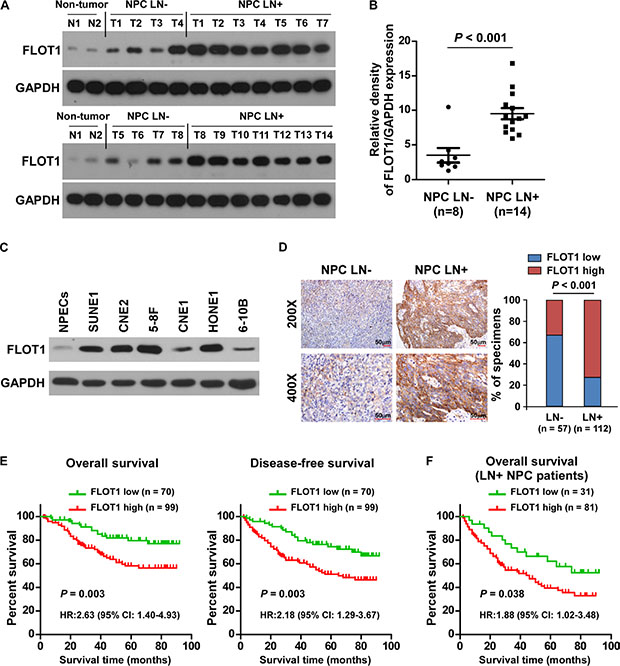 Upregulation of FLOT1 correlates with lymph node metastasis in human NPC.