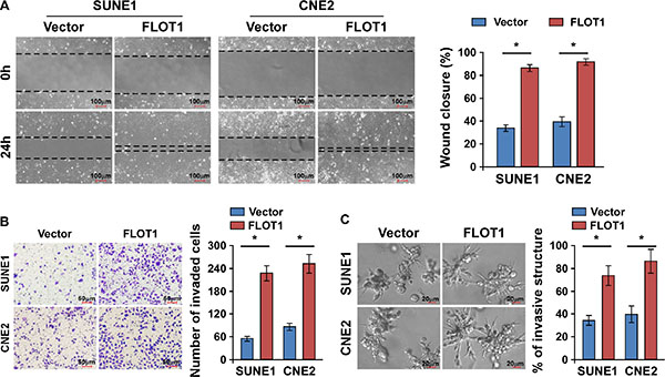 FLOT1 enhances the migration and invasion of NPC cells.