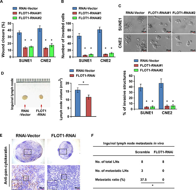 Downregulation of FLOT1 suppresses the aggressiveness of NPC cells.