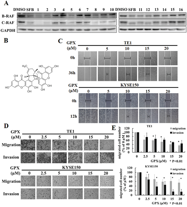 Griffipavixanthone (GPX) inhibits esophageal cancer cell migration and invasion.
