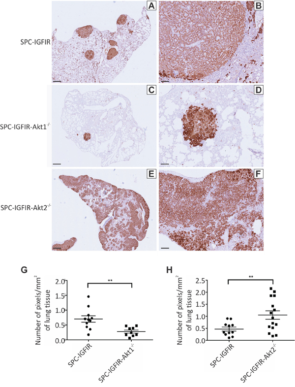 Tumor burden is increased in mice lacking Akt2 but decreased in mice lacking Akt1.