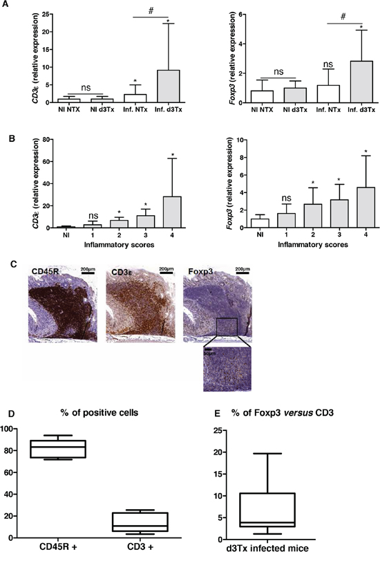 Evaluation of the lymphocytic infiltration in infected d3Tx mice stomachs.