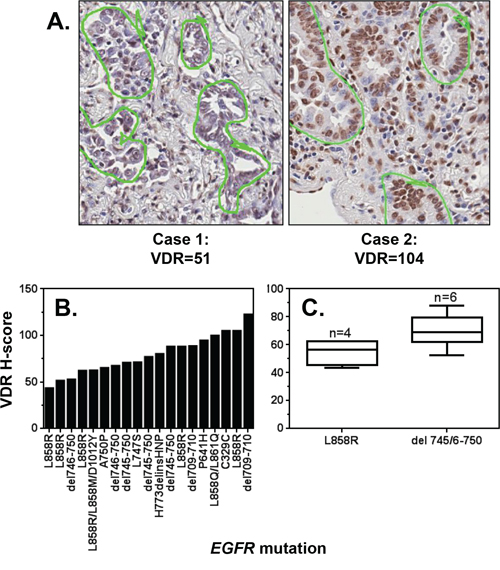 VDR is expressed in EGFR mutant tumors.