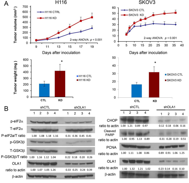 Figure 1. Knockdown of OLA1 promotes tumor growth in vivo.