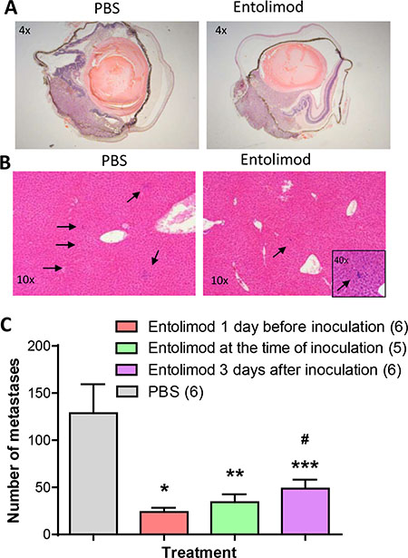 Effect of entolimod treatment on liver metastasis of B16LS9 UM tumors following enucleation of the tumor-bearing eye.