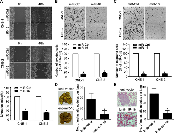 miR-16 inhibits NPC cell migration, invasion, and lung metastatic colonization.