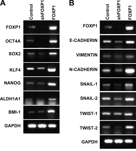 FOXP1 promotes expression of stemness-related genes and EMT-related genes.