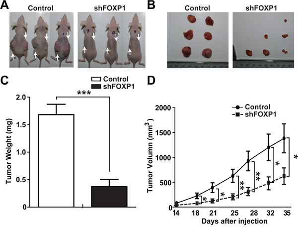 FOXP1 knockdown inhibits tumor growth in xenotransplantation of A2780 ovarian cancer cells.