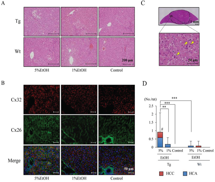 Figure 1. EtOH intake after DEN injection enhances hepatocarcinogenesis in Tg rats.