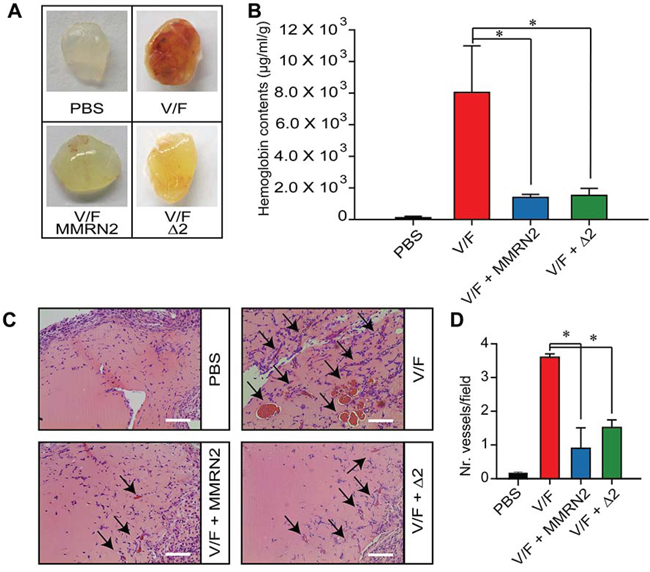 MMRN2 and the &#x0394;2 deletion mutant impair the development of blood vessels in the in vivo Matrigel plug assay.