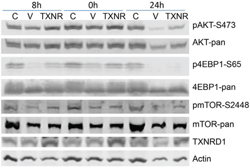 Figure 5. Effect of TXNRD1 expression in auranofin medicated inhibition of PI3K/AKT/mTOR pathway.