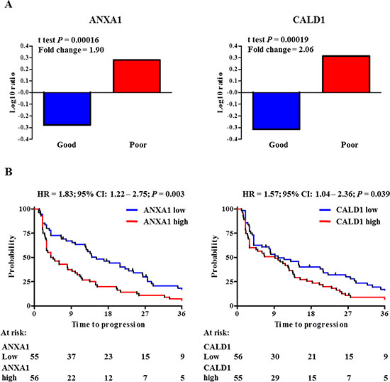 ANXA1 and CALD1 expression levels and survival analyses in MS cohorts.