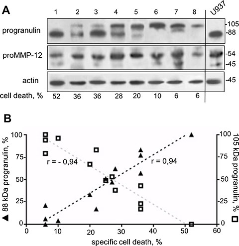 Expression of a distinct 105 kDa progranulin isoform in AML specimens.