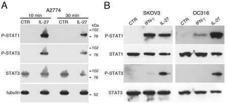 IL-27 induces STAT1 and STAT3 phosphorylation (P) in EOC cell lines