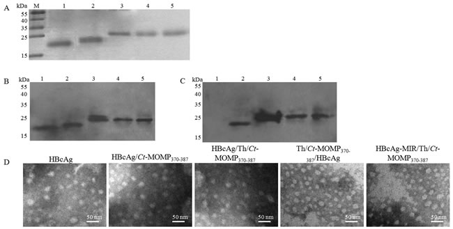 Expression of recombinant proteins and formation of HBcAg/MOMPm chimeric VLPs.