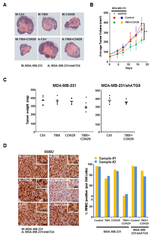 Combination of TMX and COH29 reduces tumor growth