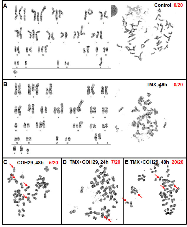 Combination of TMX and COH29 causes chromatin gaps and breakage.