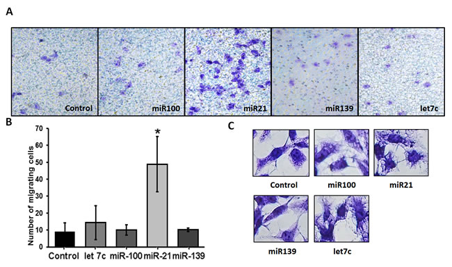 Effect of miRNA-100, -21, -139 and let 7c transfection on migration of WPMY-1 cells.