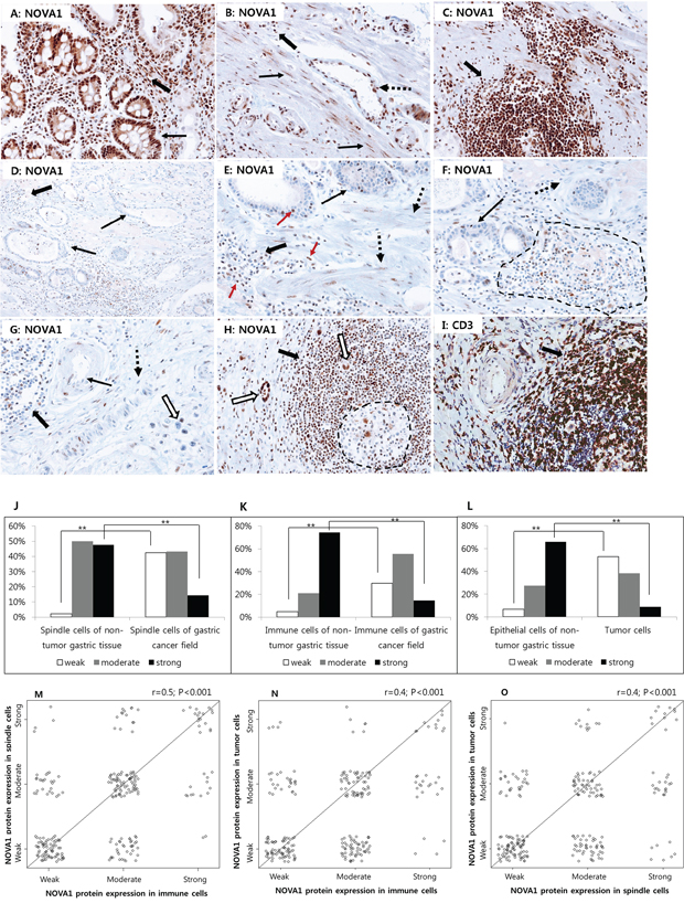 Figure 4. NOVA1 protein expression in non-tumor gastric tissues and gastric cancer tissues.