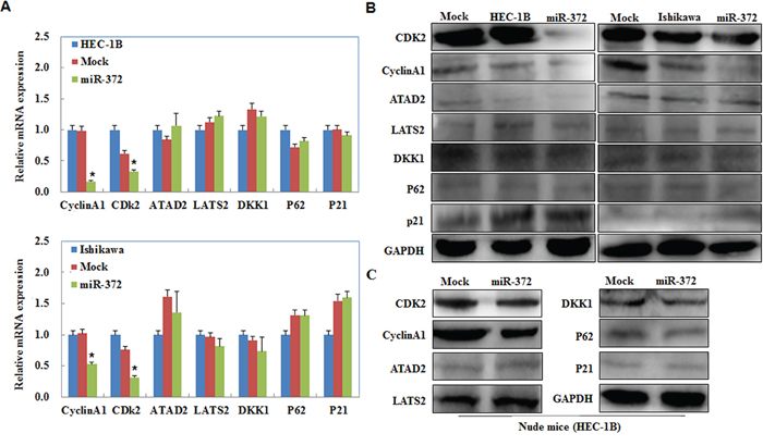 Effects of miR-372 transfection on endometrial adenocarcinoma cell genotype in vitro and in vivo.