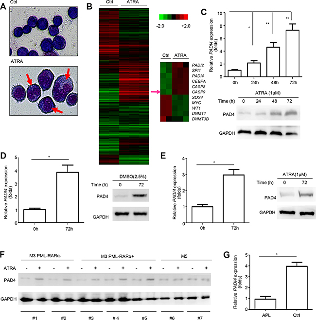 PAD4 expression increased during the differentiation of leukemia cells.