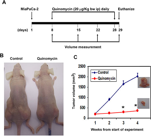 Quinomycin inhibits pancreatic cancer xenografts.