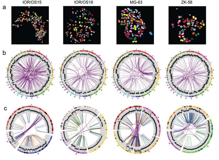 Visualization of the genomic chaos in osteosarcoma.